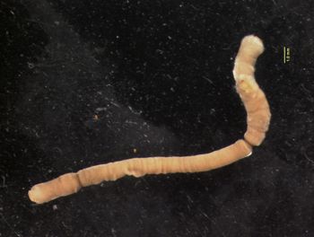 Media type: image; Malacology 302677   Description: Chaetoderma;